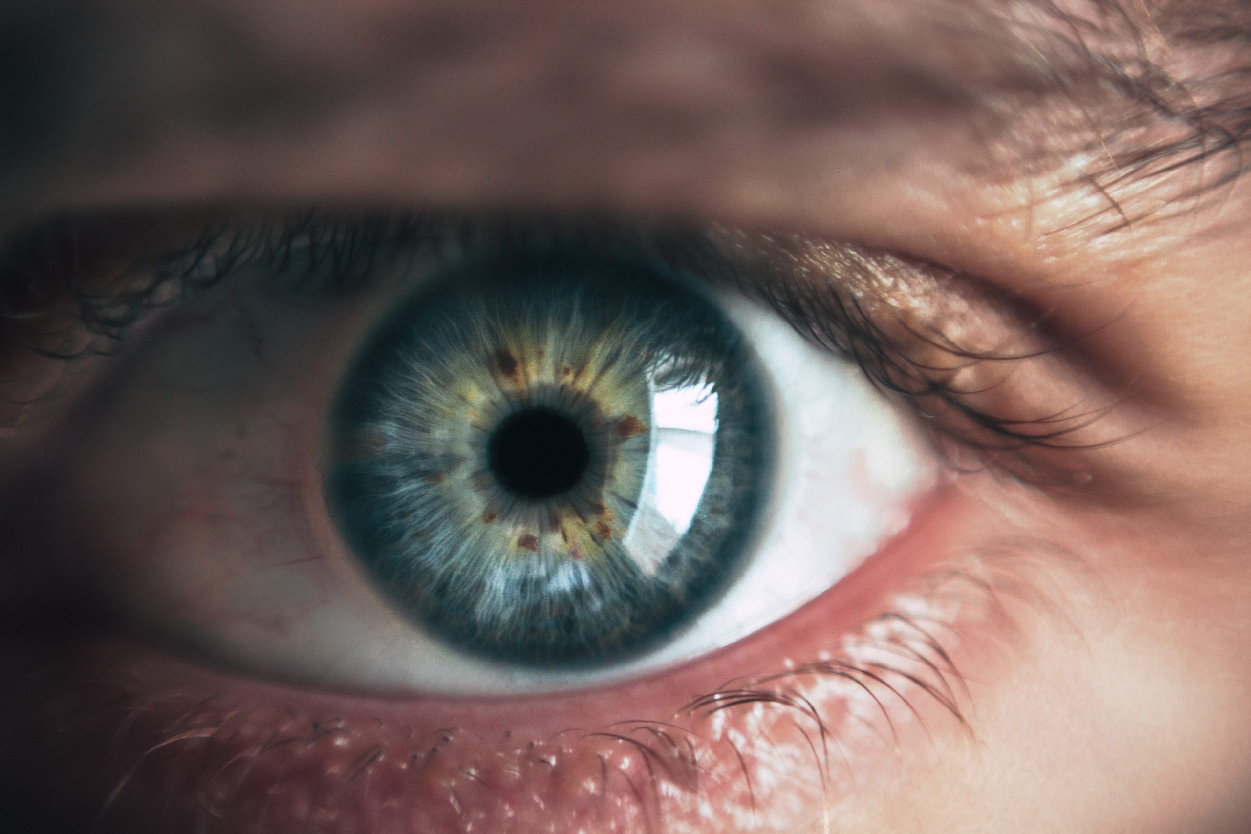 Remedio natural conjuntivitis – Qué hacer cuando tienes conjuntivitis